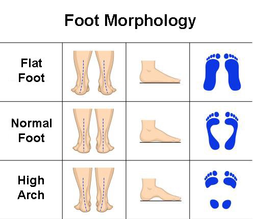 Know Your Foot Types